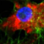 Nanomedicina experimental elimina leucemia em testes com animais