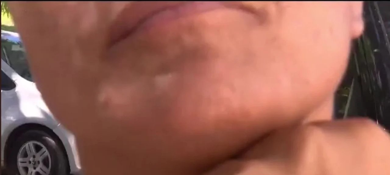 Mulher de 43 anos denuncia marido por agressão e deslocamento de maxilar na Serra - Imagem do artigo