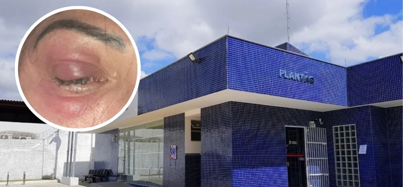 Policial penal de 49 anos acusa namorado de agressão em Vila Velha e solicita medida protetiva - Imagem do artigo