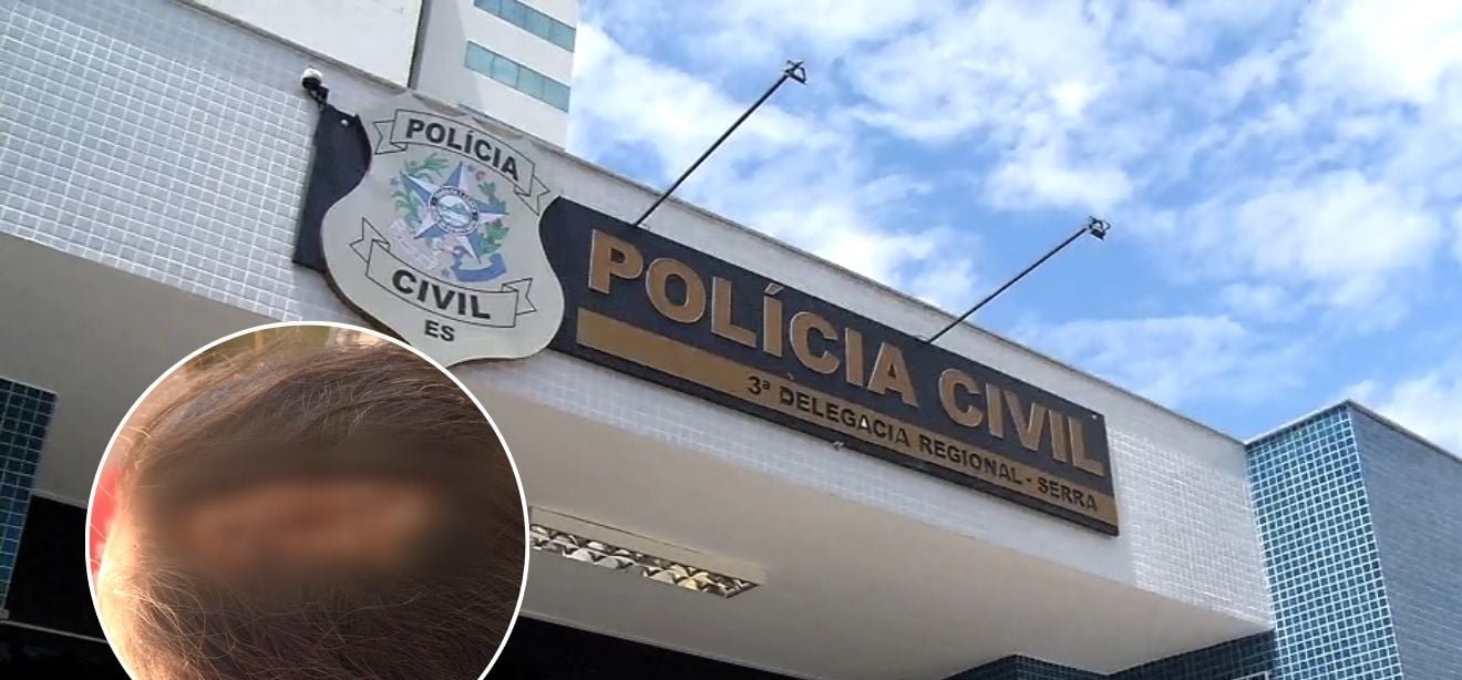 Mulher é agredida com ripa após pedir que marido parasse de usar drogas na Serra - Imagem do artigo original