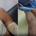 Agressão em Guarapari resulta na prisão de namorado de mulher trans